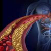 What is Cholesterol-Why Do You Need to Control It.PSD