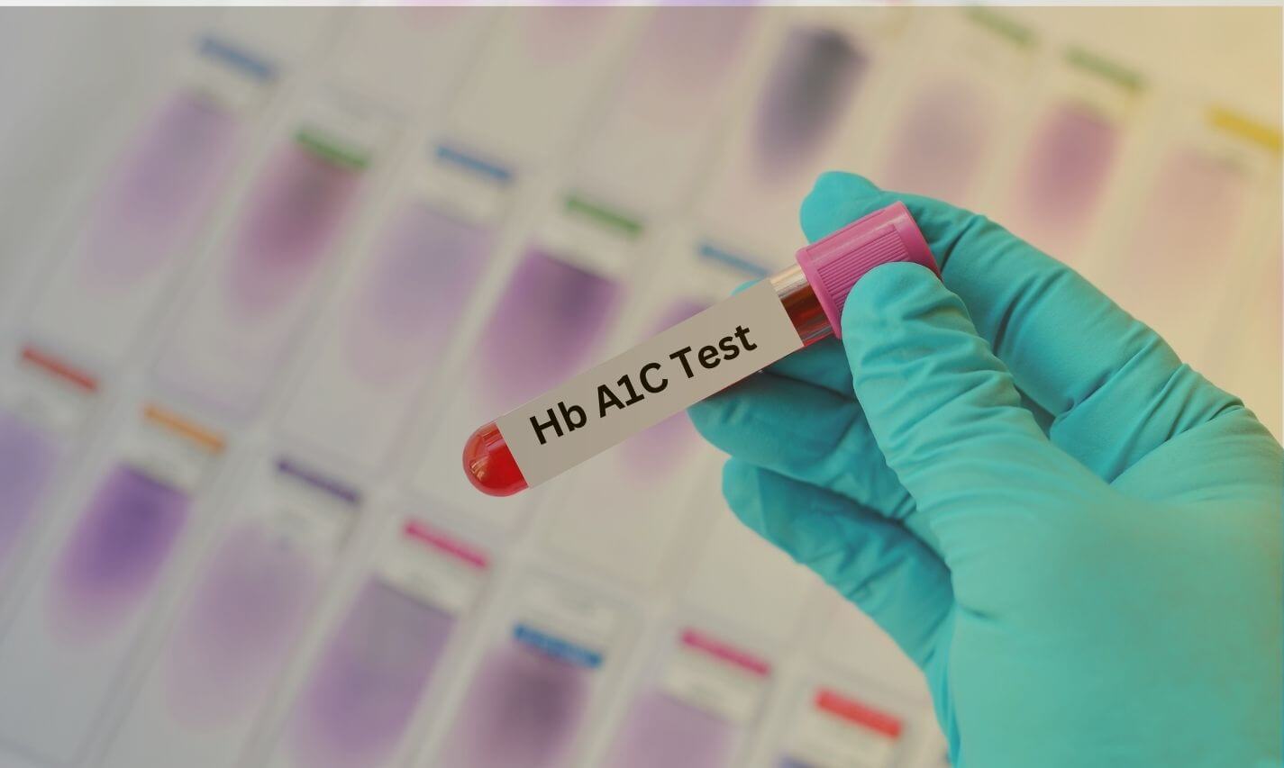 The Ultimate Guide to HbA1c Hemoglobin Testing and Results