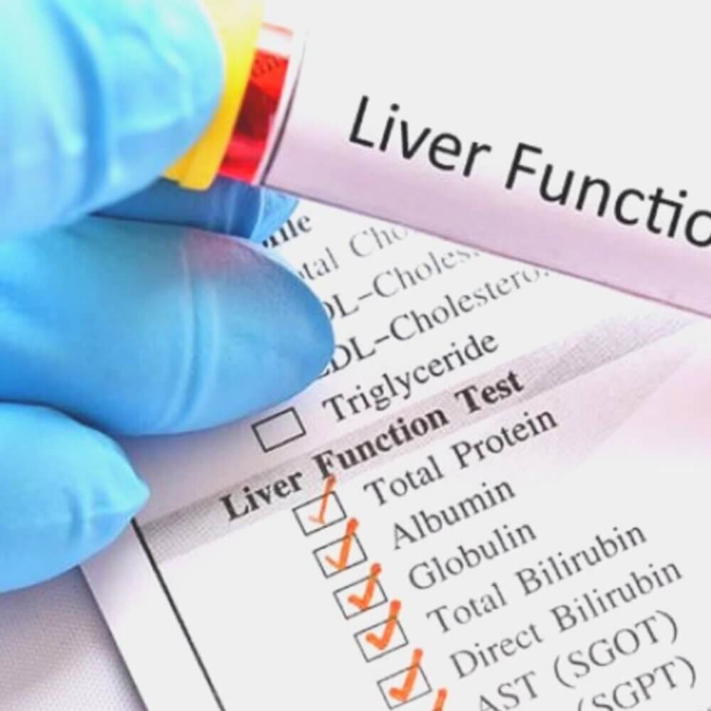 liver-function-tests-information-about-its-types-and-purposes