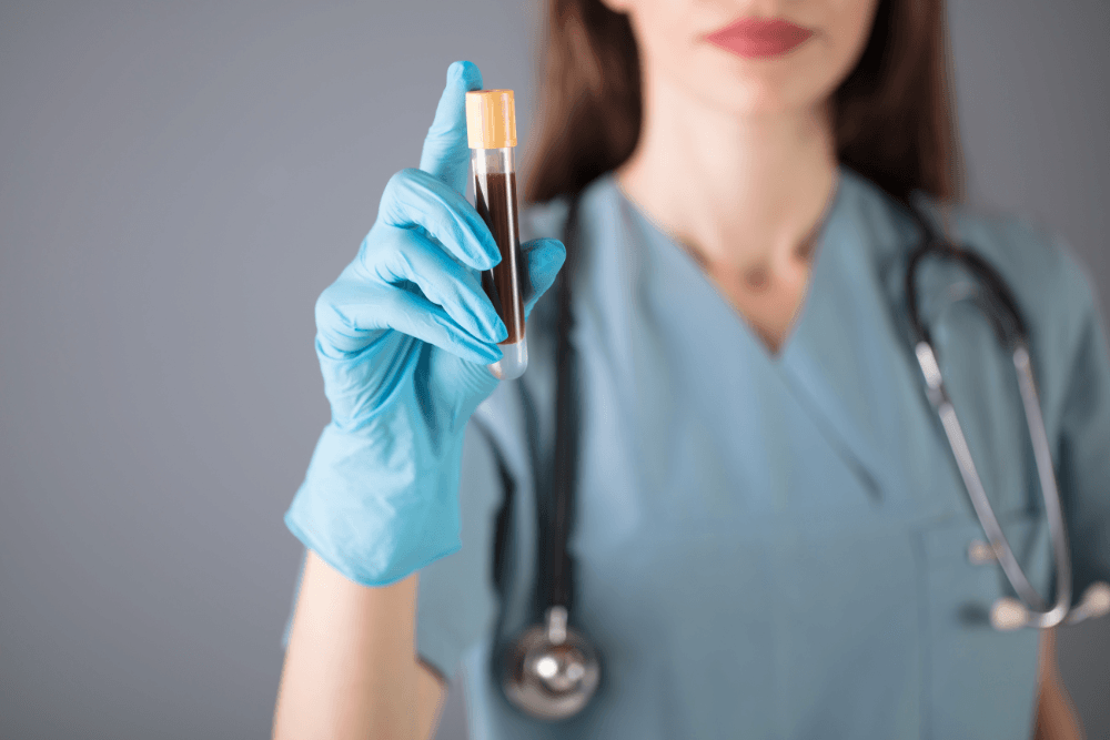 Complete Blood Count (CBC) Test: Your Simple Guide to Understanding the Results